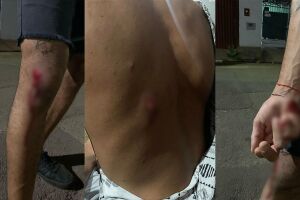 Jovens s&atilde;o espancados por dupla e relatam homofobia: 'pareciam animais' (v&iacute;deo)