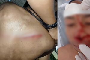 Corregedoria da PM vai investigar policial por agressão durante o Carnaval de Corumbá (vídeo)