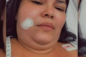 Com neuralgia do trig&ecirc;meo, mulher lan&ccedil;a campanha para custear cirurgia 