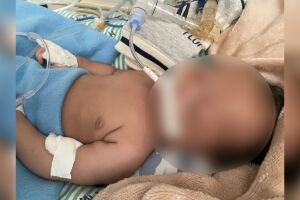 Após conseguir vaga, mãe pede orações pela recuperação de bebê com bronquiolite