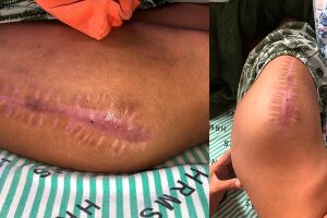 Perna do adolescente que aguarda atendimento ortopédico