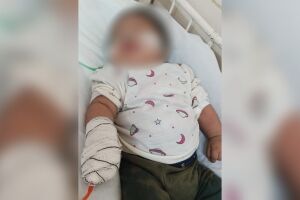 Com pneumonia grave, bebê aguarda por vaga em hospital em Campo Grande