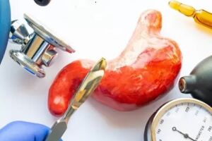 Nova regra permite cirurgia bariátrica para adolescentes a partir de 14 anos