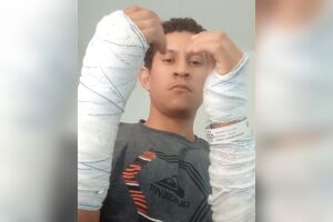 Com mão quebrada em três lugares, trabalhador é mantido em jejum por dias à espera de cirurgia