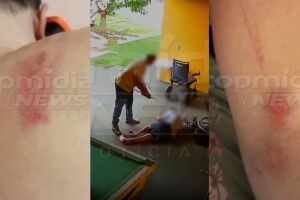 Marcas no corpo da vítima após ser espancado
