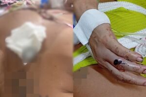 Paciente está na enfermaria