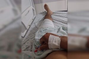 Após uma semana de espera, motoentregador realiza cirurgia no fêmur na Santa Casa