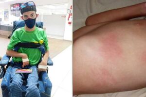 'Ele não consegue sair de casa': jovem com paralisia sofre após cadeira ser danificada em voo