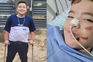 Ap&oacute;s trombose, Lucas v&ecirc; cirurgia esperada por meses perder efeito e precisa recome&ccedil;ar