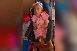 Mãe luta para trocar sonda vencida da filha com paralisia cerebral: 'Cada ajuda faz diferença'