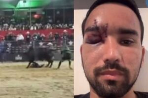 Peão de Cassilândia que quase perdeu olho em rodeio se pronuncia (vídeo)