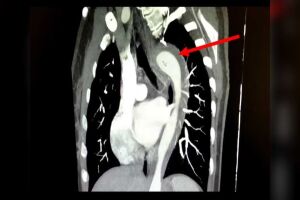Será que foi bom? Mulher rompe aorta durante orgasmo ao fazer 'rapidinha' com o marido