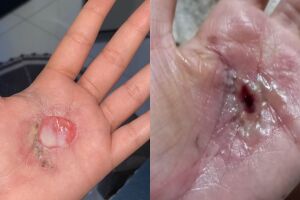 Vítimas denunciam pai de santo por tortura e ameaças em terreiro na Nhanhá (vídeo)