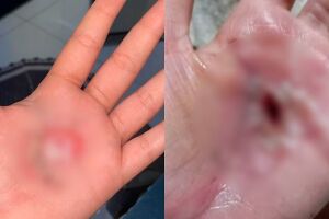 Mão das vítimas do pai de santo