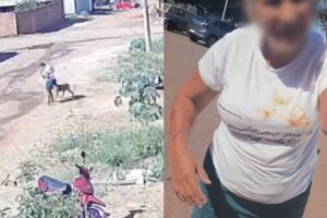 Câmera registrou ataque de pitbull contra idosa no Parque Novo Século (vídeo)