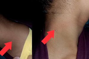 O menino ficou com marcas no pescoço após ser amarrado por uma corda