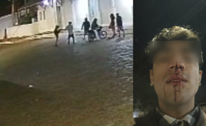 Jovem &eacute; espancado por dez homens por beijar rapaz na Esplanada Ferrovi&aacute;ria (v&iacute;deo)