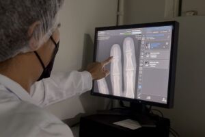 Aparelhos entregues são de alta resolução 