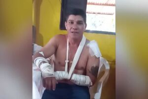 Rapaz que sobreviveu a ataque de onça conta experiência em Rio Verde (vídeo)