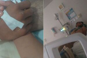 Motoentregador perde movimentos do lado esquerdo do corpo após acidente em Campo Grande 