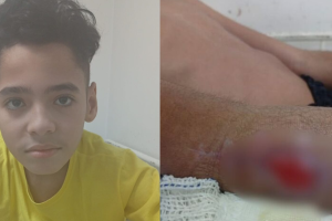 Mãe reclama de espera em cirurgia de filho internado há 65 dias; Santa Casa diz aguardar material