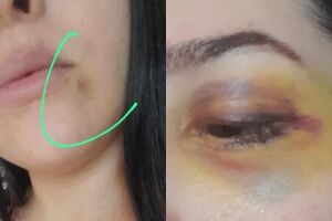 'Meu filho já me viu ser enforcada': mulher relata histórico de violência e cobra prisão do ex