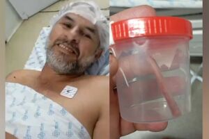 Pescador atacado por peixe cachara passa por cirurgia e está fora de perigo