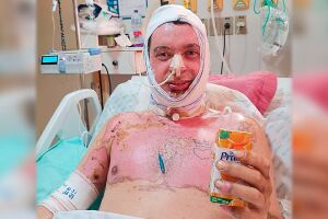 Geovane deve passar por nova cirurgia na traqueia