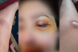 Mulher 'some' para fugir do ex-marido após seis anos de agressões: 'vivo escondida e com medo'