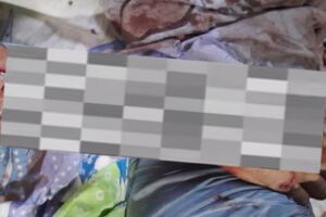 Homem é gravemente ferido após ataque de onça-pintada no Pantanal