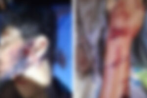 A vítima foi socorrida em estado grave