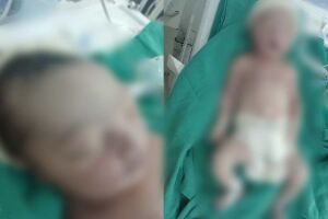 "Vocês são jovens, podem fazer outro", diz médico após bebê nascer morto em Campo Grande