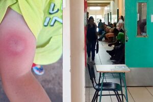 Mãe procura Upa após seu filho ser picado por aranha e tem que aguardar 3 horas