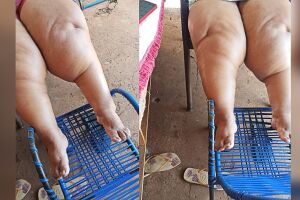 Sem atendimento e conseguir trabalhar mulher viv da ajuda dos amigos e familiares