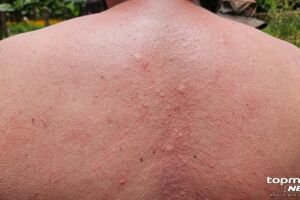 Idoso é atacado por enxame de abelhas em quintal de casa