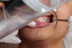 Conselho denuncia paralisação na odontologia e questiona 'sumiço' de R$ 4 milhões em Campo Grande