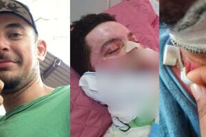Cirurgia na traqueia deixa jovem com sequelas graves e fam&iacute;lia lamenta demora no tratamento