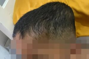 Bab&aacute; &eacute; denunciada por agress&atilde;o contra crian&ccedil;a autista em Alagoas