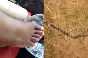Caminhoneiro &eacute; picado por jararaca no Pantanal e dirige por horas em busca de socorro