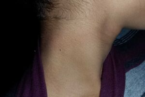 Adolescente de 16 anos sofre tentativa de estrangulamento e foge para escapar do namorado 