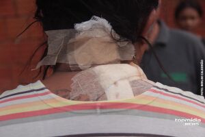 Mulher &eacute; esfaqueada no pesco&ccedil;o pelo marido em Dourados