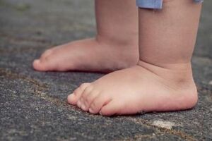 Beb&ecirc; de 1 ano internado por suspeita de estupro morre em Campo Grande (v&iacute;deo)