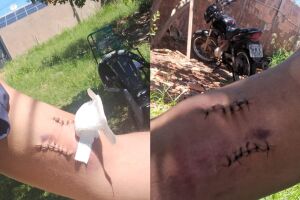 Baleado no bra&ccedil;o, homem contesta vers&atilde;o oficial e diz que foi cobrar d&iacute;vida antes de ser atacado