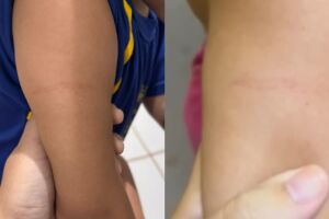 Crian&ccedil;a diz que apanhou de professora e m&atilde;e denuncia Emei no Itamarac&aacute; (v&iacute;deo)