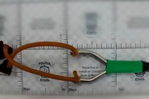 Atingido por pedrada disparada por estilingue, homem pode ficar cego de um olho em Campo Grande
