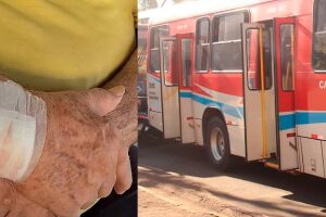 Idoso pede ajuda de jovem para embarcar em &ocirc;nibus e &eacute; agredido com golpes de bengala 