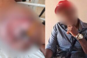 Cadeirante diz passar fome por ter que comprar curativos que deveriam ser dados em posto de sa&uacute;de