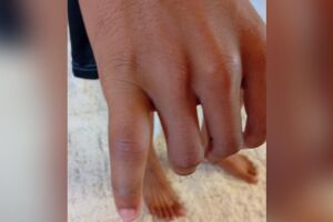 O adolescente retornou para casa depois de horas sem atendimento 