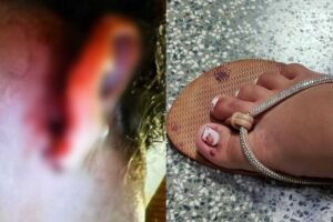 Suspeito de estuprar beb&ecirc; provocou aborto na m&atilde;e da crian&ccedil;a; menina est&aacute; em estado grave (v&iacute;deo)