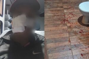 Bala perdida atravessa telhado e atinge homem no rosto; fam&iacute;lia vive dias de medo no Los Angeles
